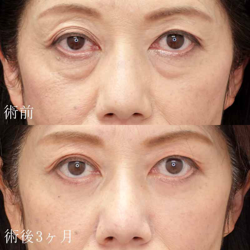 🇰🇷, 韓国美容クリニック行ってきた✨️,韓国肌 韓国美容皮膚科 韓国情報