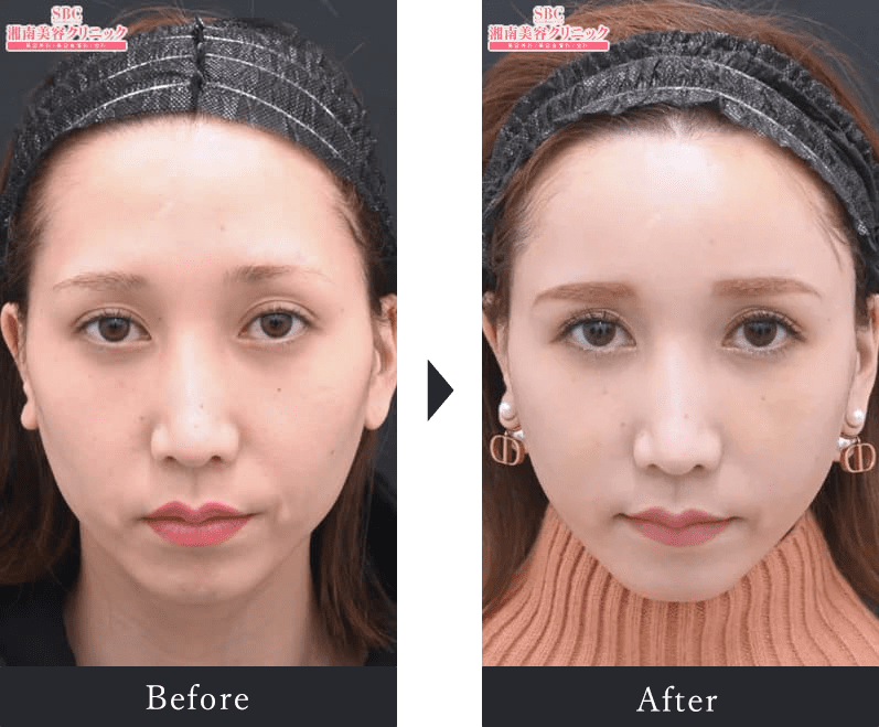 COM'S LibLi 湘南T-SITE